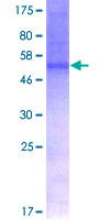 12.5% SDS-PAGE Stained with Coomassie Blue.